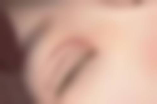 眉骨高做双眼皮好看吗？结合图片解析眉骨高割双眼皮的自然效果与改善提升