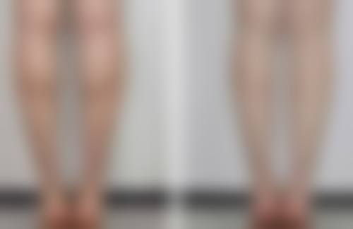 七、结尾：隆胸后可以用力抓吗身体？