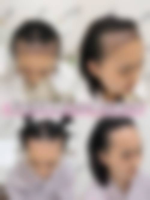 三、淮北旭美医疗美容诊疗项目有哪些？