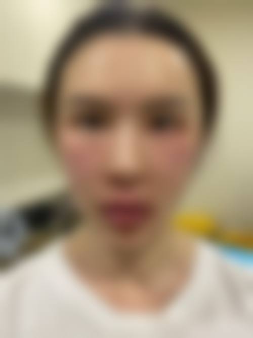 四、淮北旭美医疗美容特色项目