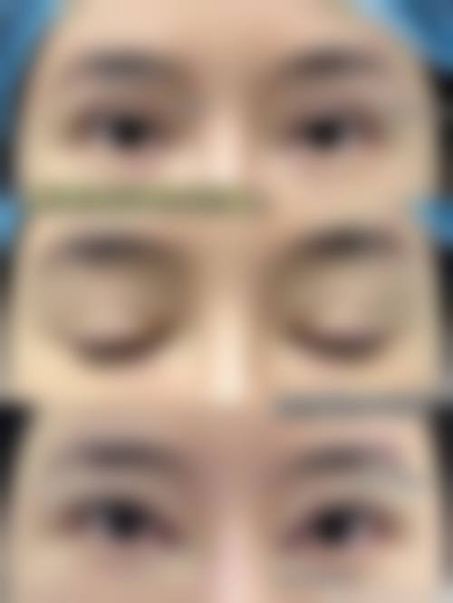 五、周爱民怎么预约？