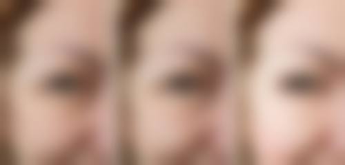 三、深圳优德医疗美容诊所诊疗项目有哪些？