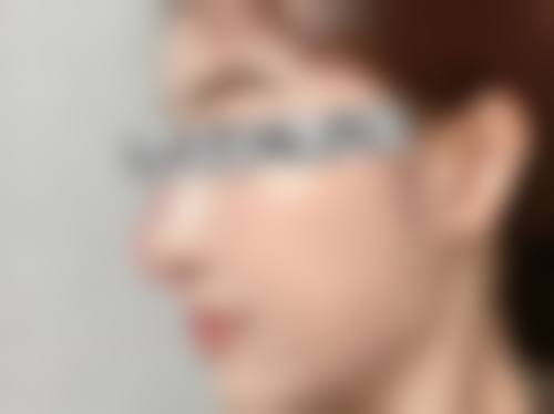 九、深圳优德医疗美容诊所真实的患者评价