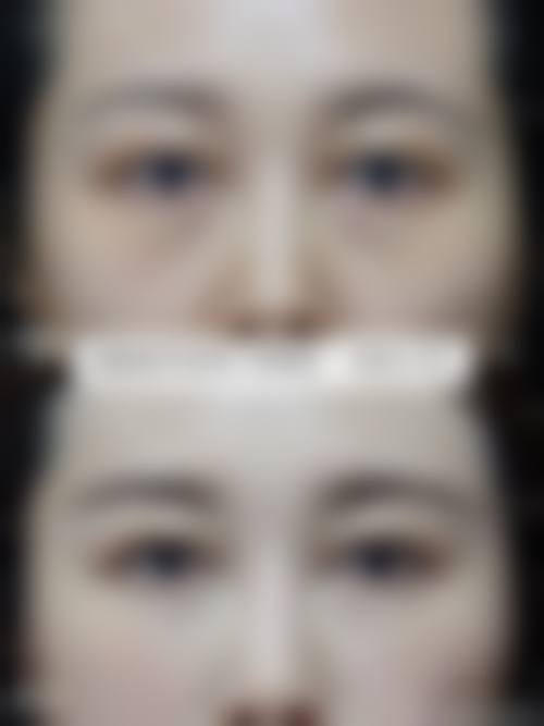 四、襄阳倍加美整形医院特色项目