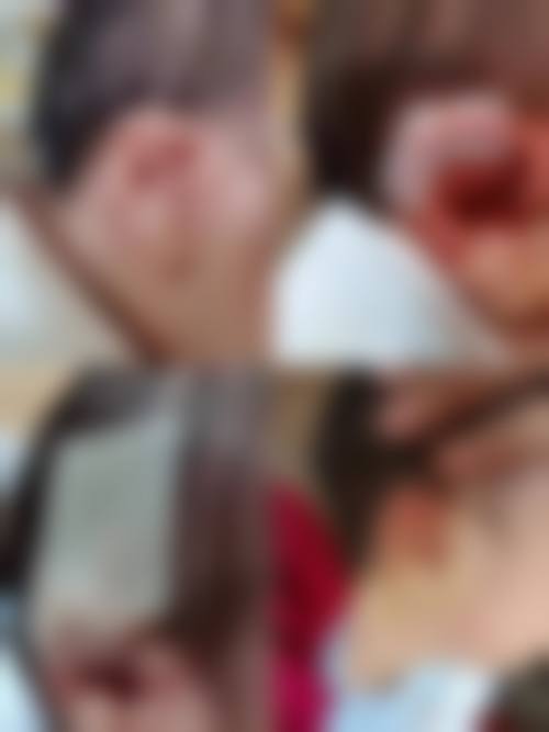 八、襄阳倍加美整形医院真实的患者评价