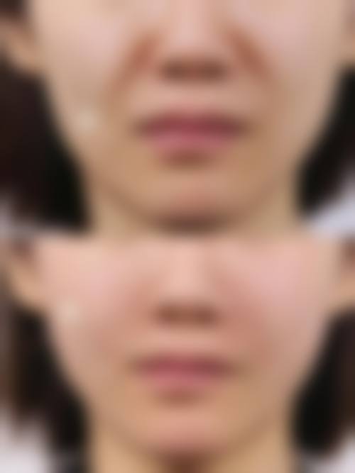 三、襄阳倍加美整形医院诊疗项目有哪些？