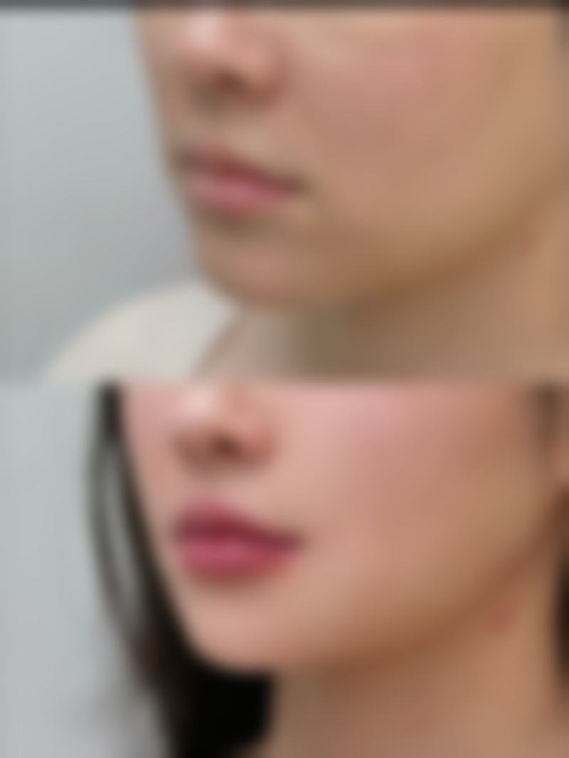 七、江门博润皮肤诊所预约方式