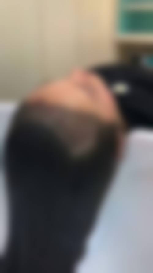 五、西宁碧莲盛植发医院医生介绍