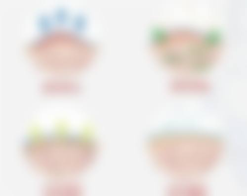 三、无痕双眼皮和全割的适应证区别
