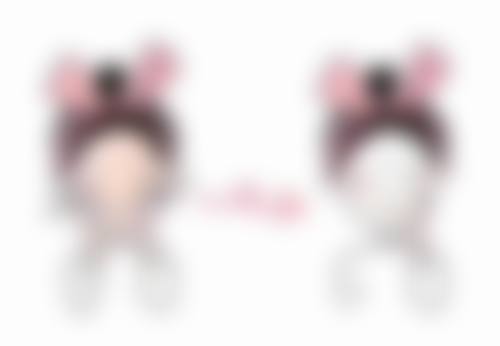 三、割双眼皮后的留疤风险及应对措施