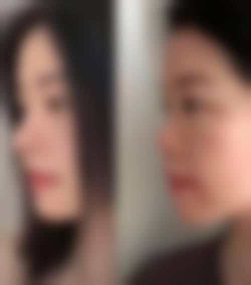 五、焦作英姿医疗美容医院价格表