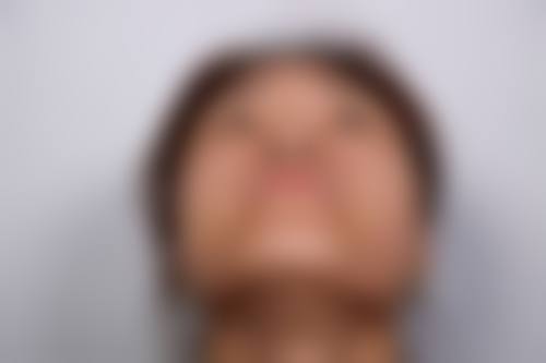 八、徐州沃美医疗美容门诊部真实的患者评价