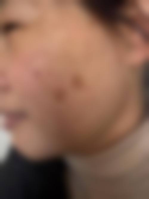 三、韩国slow整形外科医院诊疗项目有哪些?