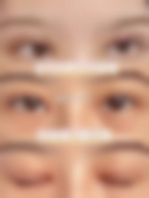 二、杨松林医生擅长项目