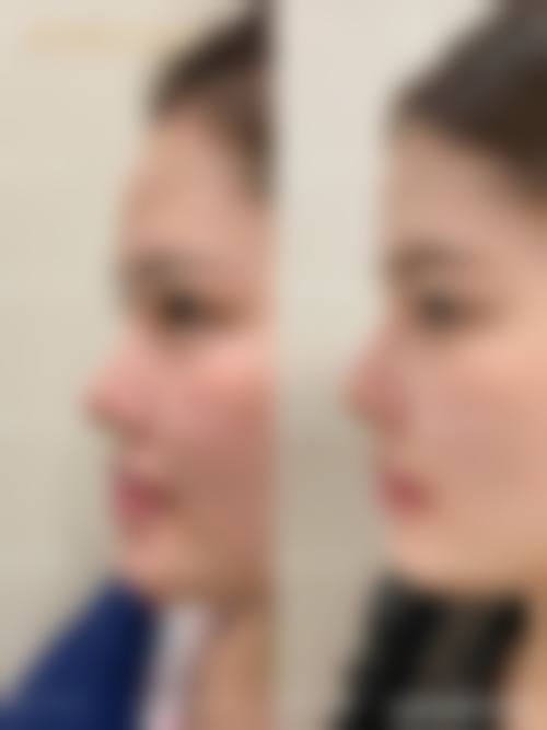 四、银川奥蕊斯医疗美容门诊特色项目