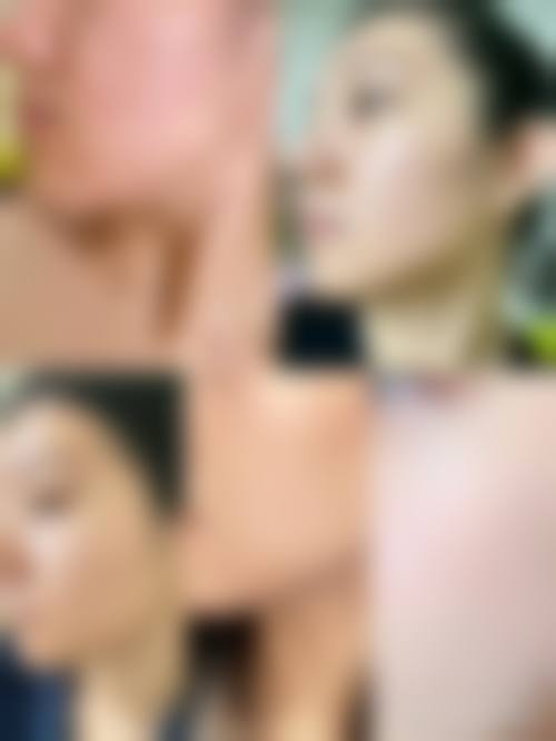 八、北京张正红医疗美容诊所真实的患者评价