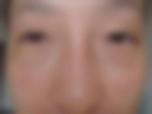 三、韩国美来整形医院诊疗项目有哪些？