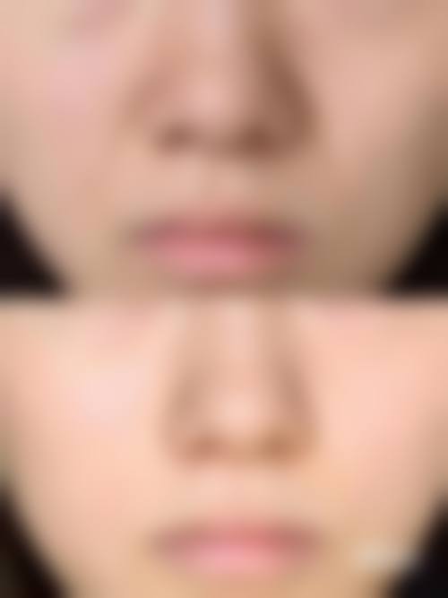 四、韩国美来整形医院特色项目