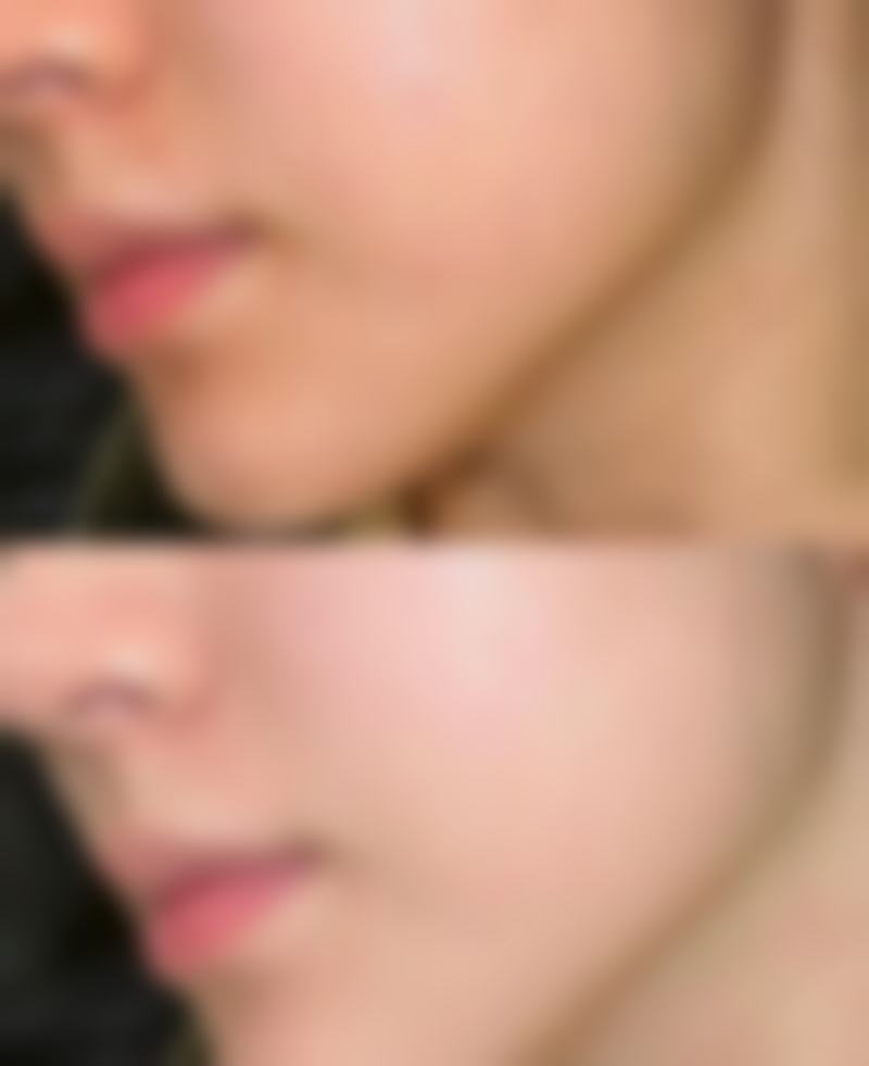 七、小综合隆鼻包括什么项目？结尾总结