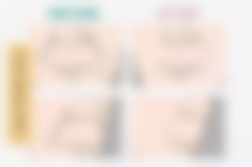 五、蒙克脸能去掉眼袋吗？总结真相