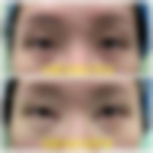 四、菏泽韩后医疗美容门诊部特色项目