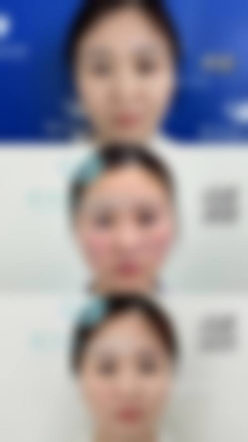 四、咸宁白钰美肤整形医院特色项目