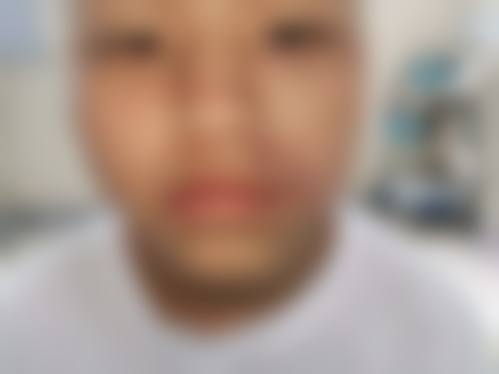 四、上海诠韩医疗美容整形医院特色项目