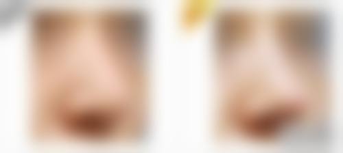 四、SaranonPaisanphan收费价格表