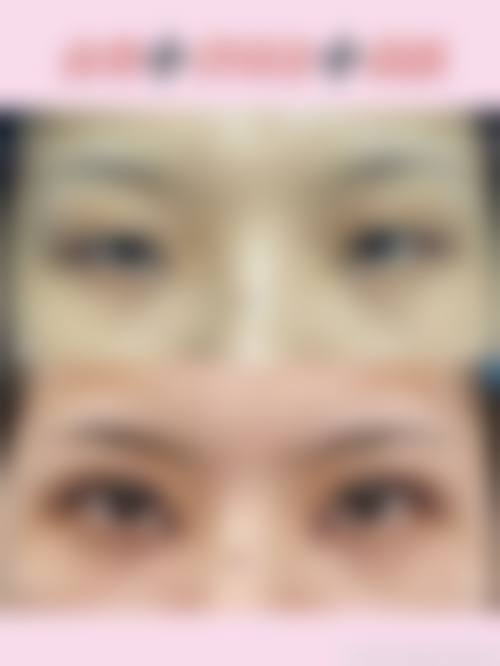 三、黔南州中医院美容整形科诊疗项目有哪些?
