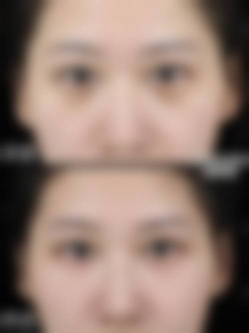 八、天门忆美整形美容机构真实的患者评价
