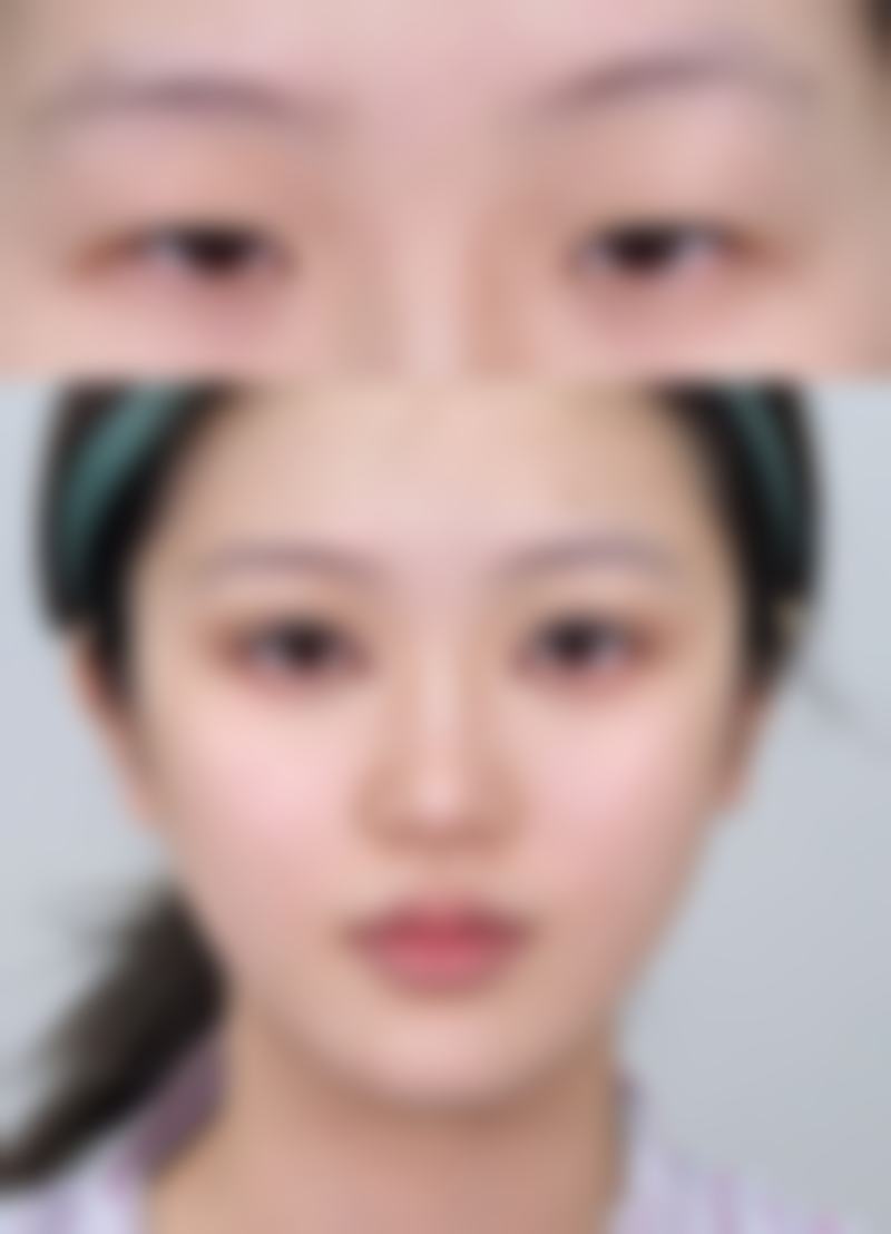 九、黔南州中医院美容整形科真实的患者评价