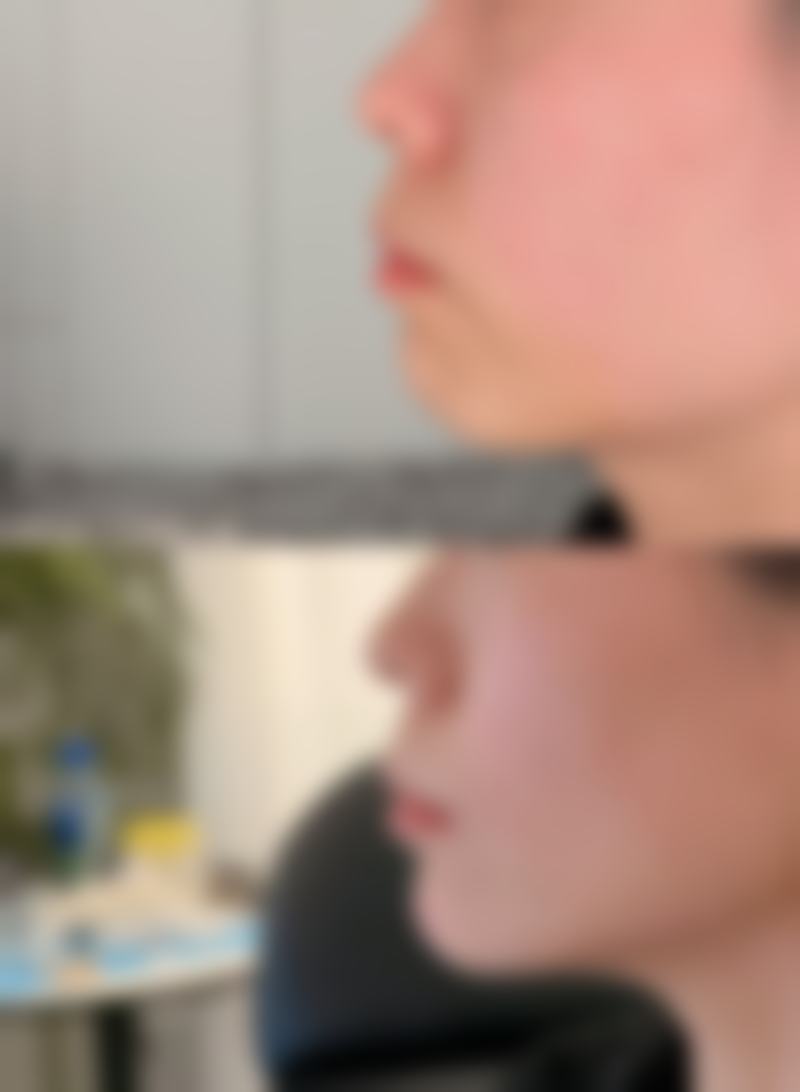 四、保定宸星整形医院特色项目