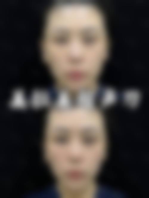 九、南阳时光整形美容医院真实的患者评价
