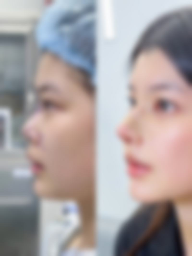 八、贵港美菲思医疗美容门诊部真实的患者评价
