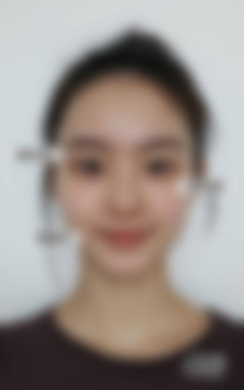 八、保定至臻医疗美容真实的患者评价
