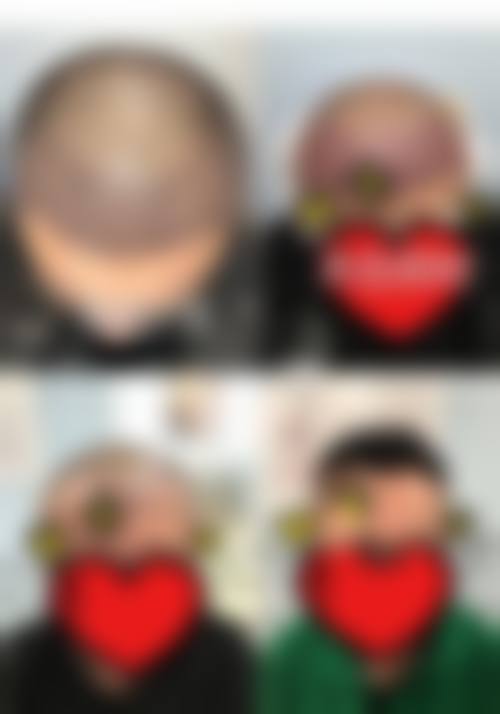 三、保定至臻医疗美容诊疗项目有哪些?