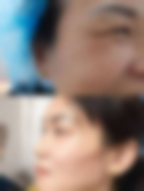 五、保定至臻医疗美容价格表