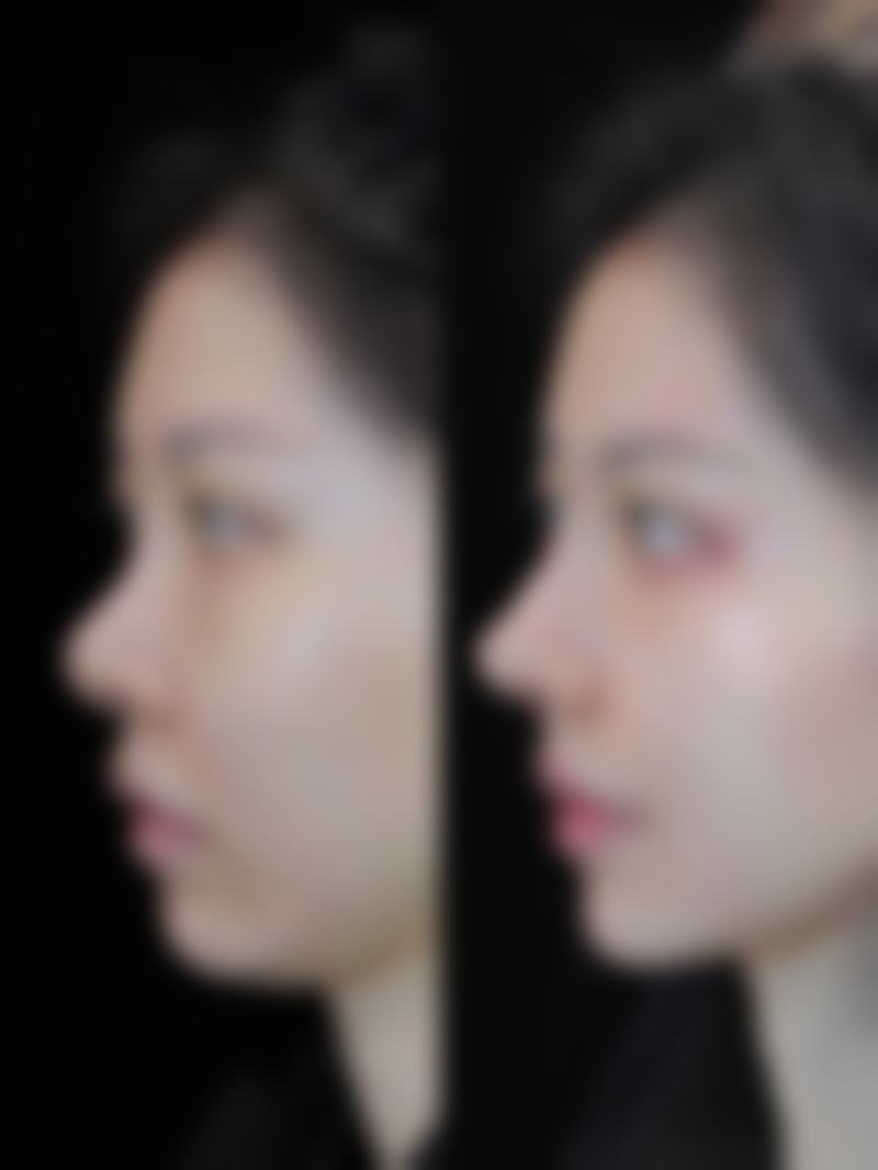 八、武汉熙妍医疗美容门诊部真实的患者评价