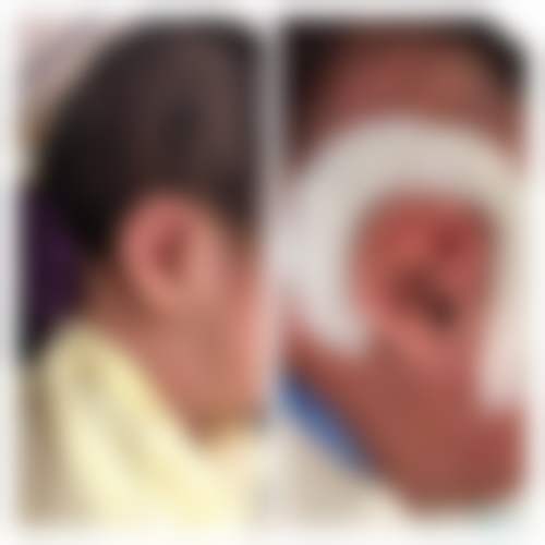 北京悦年轻医疗美容诊所口碑好不好？附真实患者口碑评价