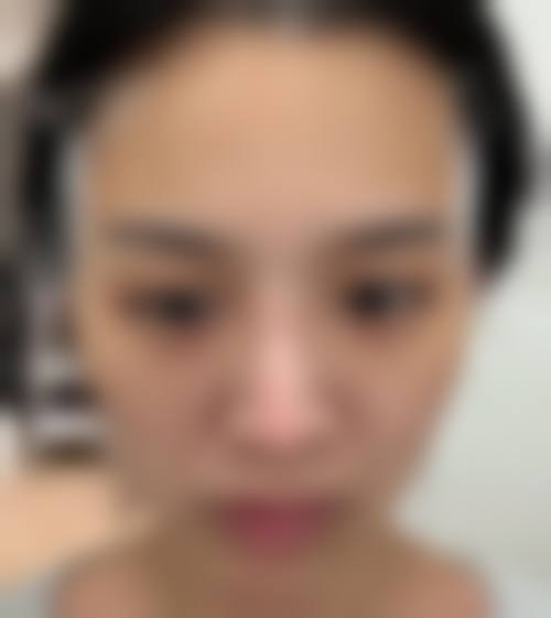 九、广西 南宁奢梵医疗美容医院真实的患者评价