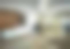 四、射极峰假体在重庆星荣整形外科医院假体垫眉弓项目中的优势