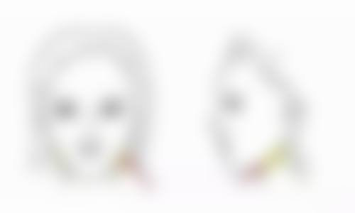 一、拉双眼皮的常见方式及保持时间