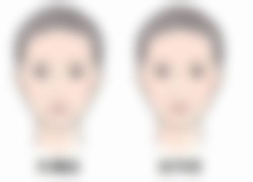 四、选择植发机构的注意事项