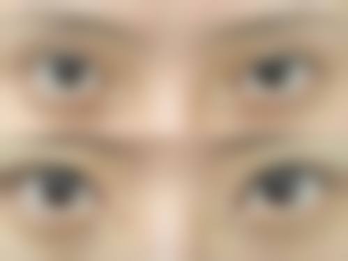 四、河南南阳爱贝尔整形特色项目