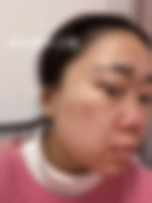 五、河南南阳爱贝尔整形价格表