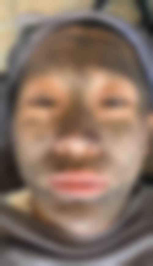 二、阜阳黛莱美医疗美容医院怎么样?