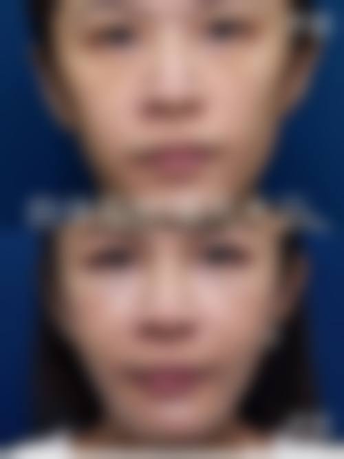 四、广州滴美整形医院特色项目