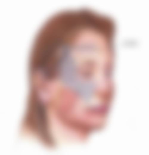 二、做双眼皮能做一只吗?单眼手术面临的风险