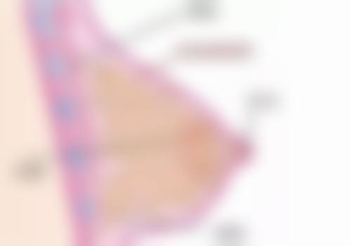 三、做双眼皮能做一只吗?处理不对称眼皮的常见方法