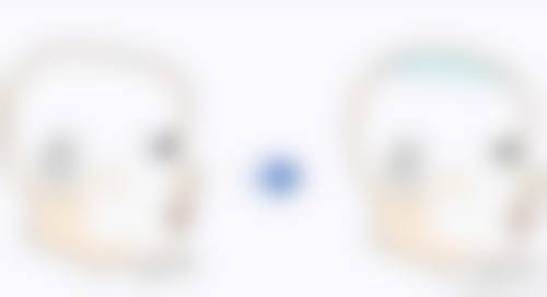 三、什么去眼袋的成效好?日常护理也重要